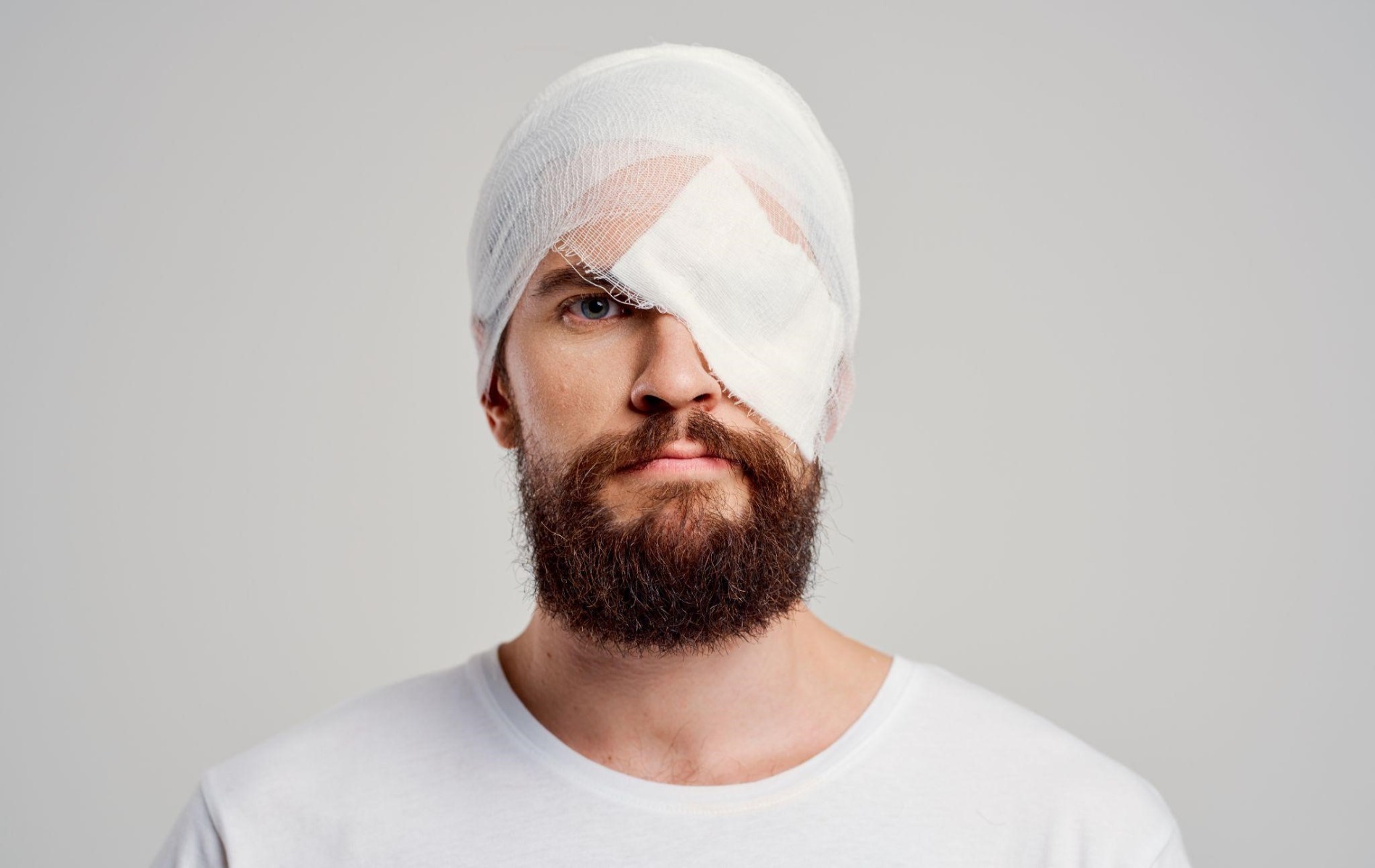 A man with an eye injury at work